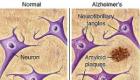 Effective preparations for the treatment of Alzheimer's disease